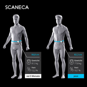 3D Körperanalyse - Fettmessung 3D Körperanalyse - Fettmessung